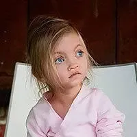 A sinistra: gruppo dibambini di diverse età affetti da sindrome del grido del gatto. A destra bambina con sindrome di Wolf