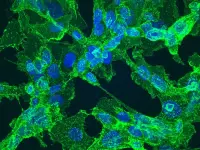 Cellule di fibrosarcoma in cui sono evidenti le proteine filamentose delle membrane cellulari (verdi) e i nuclei (blu)