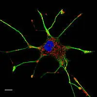 Cellula PC-12 al microscopio confocale. In blu il nucleo, in rosso i mitocondri e in verde i microtubuli