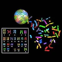 Combinazion di due immagini di cariotipi umani ottenuti con tecniche innovative