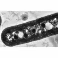 Sezione di batterio che mostra i carbossisomi, formazioni poliedriche scure