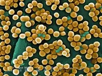 stafilococchi al microscopio a scansione