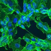 Cellule di fibrosarcoma in cui sono evidenti le proteine filamentose delle membrane cellulari (verdi) e i nuclei (blu)