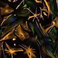 Cellule staminali isolate dal cervello in via di differenziazione in neuroni e astrociti. Foto al microscopio invertito, ingrandimento 200x