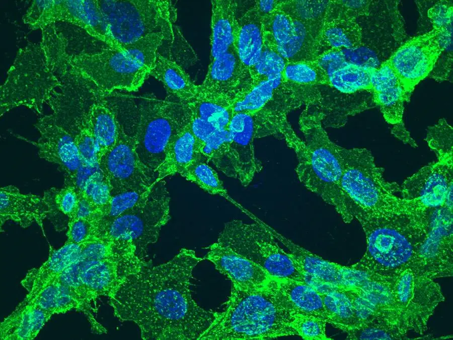 Cellule di fibrosarcoma in cui sono evidenti le proteine filamentose delle membrane cellulari (verdi) e i nuclei (blu) 