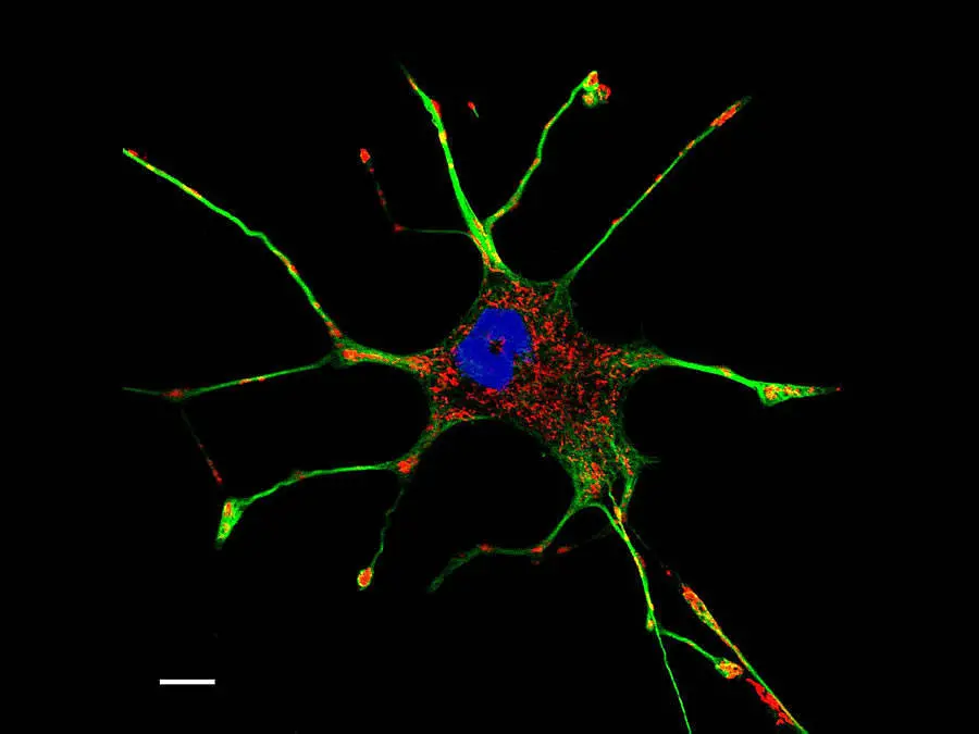 Cellula PC-12 al microscopio confocale. In blu il nucleo, in rosso i mitocondri e in verde i microtubuli