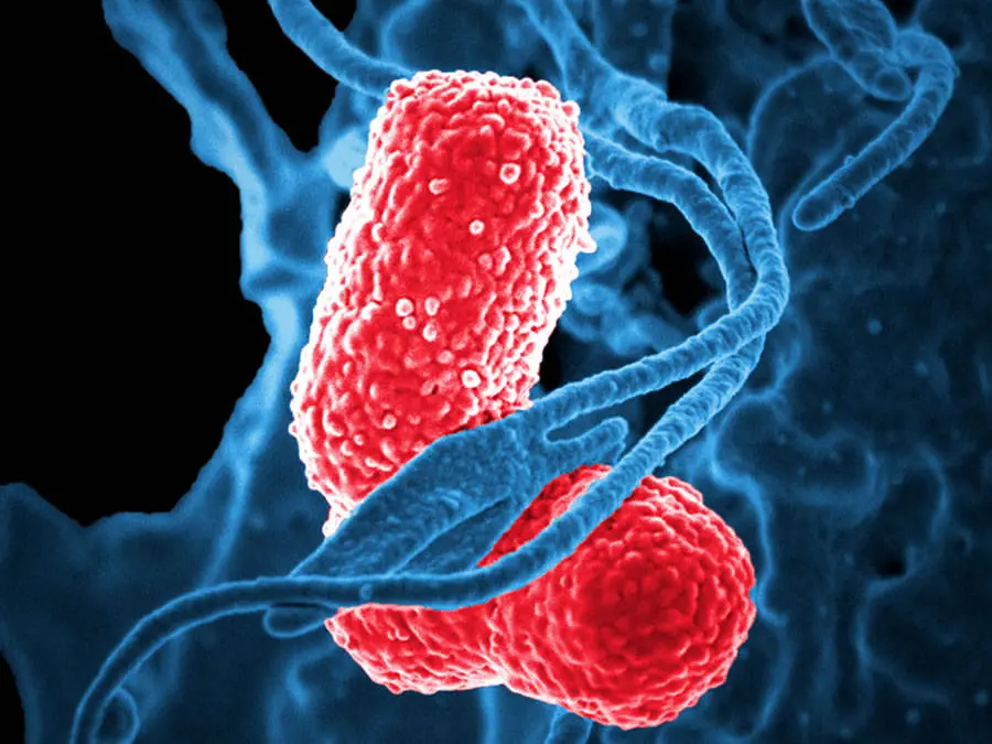 K.pneumoniae fotografata almicroscopio elettronico e circondata da un globulo bianco