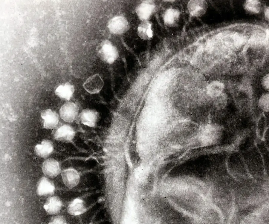 Superficie di cellula batterica attaccata da fagi. Immagine al microscopio elettronico. 