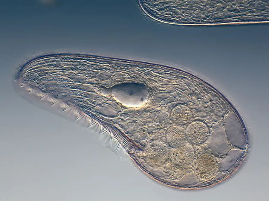 Blepharisma japonicum, esempio di ciliato